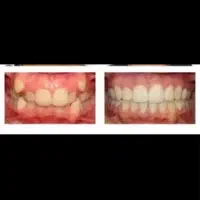 ارتودنسی با طرح اقساط و مشاوره رایگان