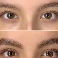 تخفیف ویژه لیفت مژه و ابرو و درماپلینگ
