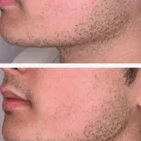 تزریقات درمانی/زیبایی/جوانسازی