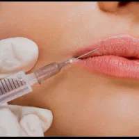 مدل جهت تزریق ژل لب و بوتاکس