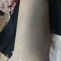 لوازم پژو ۴۰۵