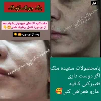 پک جوانساز بیست کاره سعیده ملک|آرایشی، بهداشتی، درمانی|بافق, |دیوار