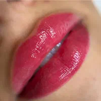تزریق بوتاکس