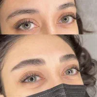 انجام تخصصی فیبروز و میکروبلیدینگ +آموزش +مدرک
