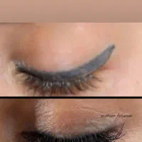 ریمو تتو اَبرو