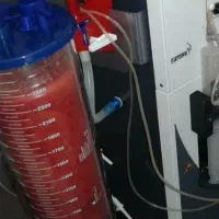 لیپو ساکشن تا عید خوشتیپ شوید|خدمات آرایشگری و زیبایی|خرم‌آباد, |دیوار