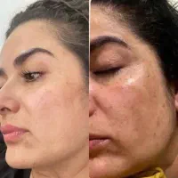 کرم بیوممتیک اصل در دفتر پخش کرمان