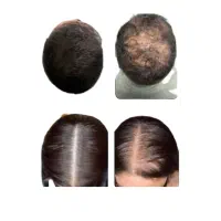 تضمینی.  رویش