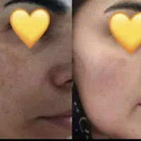 کرم معجزه اصلی تضمینی جوابدهی سریع|آرایشی، بهداشتی، درمانی|شیراز, کوشک میدان|دیوار