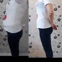 معجزه لاغریRFایکس بادیxbodyکویتیشن|خدمات آرایشگری و زیبایی|اصفهان, شهشهان|دیوار