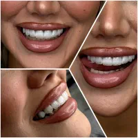 با روزی ۱۰۰ هزار تومن دندونتو ایمپلنت کن|خدمات آرایشگری و زیبایی|تبریز, |دیوار