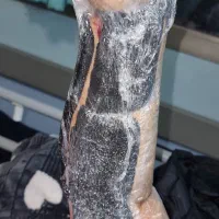 سِرم،سونداژ،تزریق،پانسمان زخم،فصد خون وکیوم تراپی|خدمات آرایشگری و زیبایی|تهران, فلسطین (میدان انقلاب)|دیوار