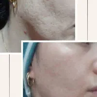 پاکسازی و فیشال پوست خانوم و اقا