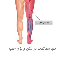 ماساژ درمانی