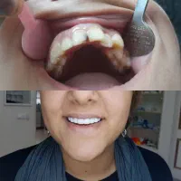 کلیه خدمات دندانپزشکی . زیبایی|خدمات آرایشگری و زیبایی|رشت, گلسار|دیوار