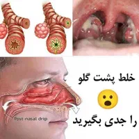 یک بار برای همیشه با کبد چرب خداحافظی کن