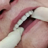 لابراتوار دندانسازی کیمیا                  اقساطی