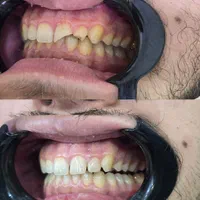 جشنواره اقساطی دندانپزشکی بدون پیش پرداخت|خدمات آرایشگری و زیبایی|شیراز, بعثت|دیوار