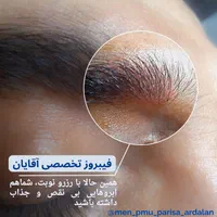 ترمیم و زیبایی ابرو (آقایان)