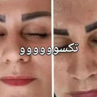 باتکسو زیبا شو اونم بدون عوارض وتضمینی|آرایشی، بهداشتی، درمانی|مشهد, شهرک ابوذر|دیوار