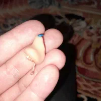 سمعک هوشمند|پزشکی|مشکیندشت, |دیوار