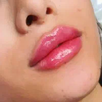 جشنواره  زیبای  کلینیک  پزشکی دکتر نوری|خدمات آرایشگری و زیبایی|اهواز, نادری|دیوار