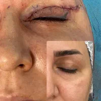 نیازمند همکاری با پزشک جراح جهت بلفارو و مربوطه|استخدام درمانی، زیبایی، بهداشتی|تهران, صادقیه|دیوار