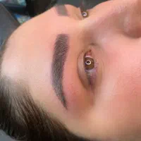 میکروبلیدینگ کرکی مویی (مدل)