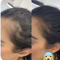 خوراک موی پرپشت