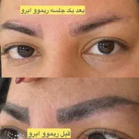 ریمو ابرو فقط تو یک دقیقه بدون زخم دوره نقاهت|خدمات آرایشگری و زیبایی|کاشان, زیدی|دیوار