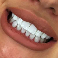 انجام خدمات دندانپزشکی