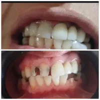 اورژانس دندانپزشکی در منزل شما شبانه‌روزی|خدمات آرایشگری و زیبایی|کرج, فاز ۱ مهرشهر|دیوار