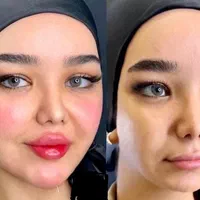 بوتاکس لیبل دار واحدی ۲۰۰ ژل اورجینال توسط پزشک|خدمات آرایشگری و زیبایی|اصفهان, احمدآباد|دیوار