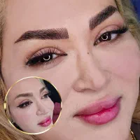 فیبروز،میکرو،روشن سازی تتوی تیره و پوست چرب