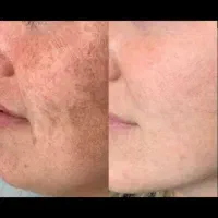 کرم ضدلک گیاهی ژل رویال|آرایشی، بهداشتی، درمانی|اسدآباد, |دیوار