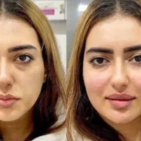 زیبایی|خدمات زیبایی و سلامت|کرج, ساماندهی|دیوار