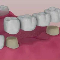 دندانپزشکی اقساطی(ارتودنسی-ایمپلنت-کامپوزیت)دندان|خدمات آرایشگری و زیبایی|مشهد, احمدآباد|دیوار