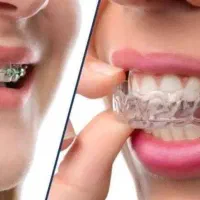 ارتودنسی مطب ماه|خدمات آرایشگری و زیبایی|تهران, عباس‌آباد|دیوار