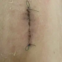 پرستار کارشناس زخم|خدمات آرایشگری و زیبایی|مشهد, احمدآباد|دیوار