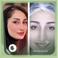 عمل بینی، پیکرتراشی، کاشت مو