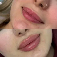 دعوت به همکاری پزشک Gp یا زیبایی دارای پروانه کار