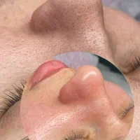 جشنواره فشیال میکروبلیدینگ ارایش دایم اسکالپ سر|خدمات آرایشگری و زیبایی|کرج, مهرویلا جنوبی|دیوار