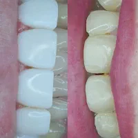 کامپوزیت زیبایی واحدی ۱،۶۰۰|خدمات آرایشگری و زیبایی|گرگان, |دیوار