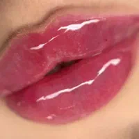 تزریق فیلر توسط پزشک