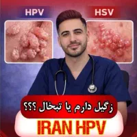 درمان قطعی زگیل تناسلی در کوتاه ترین زمان