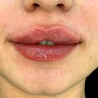 هدیه روز مادر آف ژل وبوتاکس|خدمات آرایشگری و زیبایی|ایذه, |دیوار