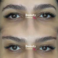 تخفیف ساکشن شکم پهلو و پشت/ هر ناحیه از بدن/بلفارو|خدمات آرایشگری و زیبایی|قم, زنبیل آباد|دیوار