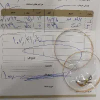 طلا