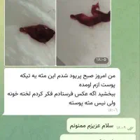 مشاوره داوطلبانه کیست سینه ورحم،تنبلی،تخمدان،|فعالیت داوطلبانه|اردبیل, |دیوار