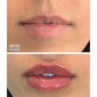 کلینیک زیبایی ترگل ورگل